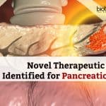 Therapeutic Targets for Pancreatic Cancer