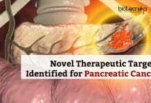 Novel Therapeutic Targets Identified for Most Lethal Pancreatic Cancer Therapeutic Targets for Pancreatic Cancer