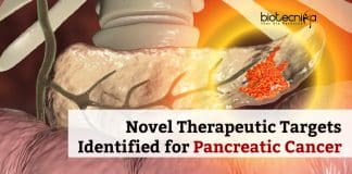 Therapeutic Targets for Pancreatic Cancer