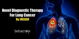 Diagnostic therapy for Lung Cancer