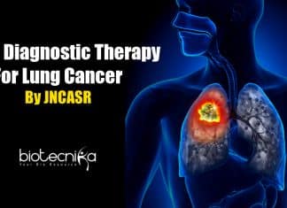 Diagnostic therapy for Lung Cancer