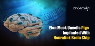 Elon Musk's Neuralink In A Pig