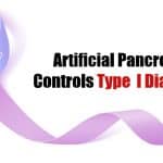 Artificial Pancreas Effectively Controls Type 1 Diabetes In Children Artificial pancreas controls diabetes