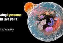 New Optical Imaging Technique By IIT Mandi Researchers To View Lysosome in Live cells Optical Imaging Technique for Lysosome
