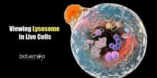 Optical Imaging Technique for Lysosome