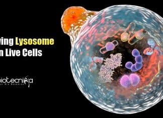 New Optical Imaging Technique By IIT Mandi Researchers To View Lysosome in Live cells Optical Imaging Technique for Lysosome