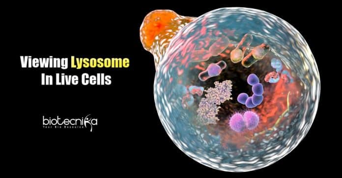Optical Imaging Technique for Lysosome