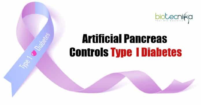 Artificial pancreas controls diabetes