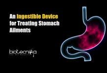 New Ingestible Device Developed For Treating Stomach Ailments Ingestible Device for Stomach Ailments
