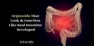 Next Generation Intestinal Organoid