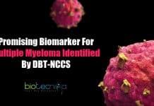 DBT-NCCS Scientists Identifies Promising Biomarker For Multiple Myeloma Promising biomarker for multiple myeloma