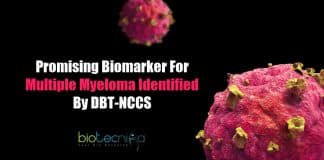 Promising biomarker for multiple myeloma