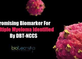 Promising biomarker for multiple myeloma