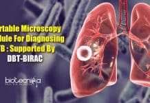 Portable Microscopy Module For Diagnosing TB : Supported By DBT-BIRAC TB diagnosing portable microscopy