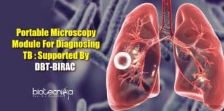 TB diagnosing portable microscopy