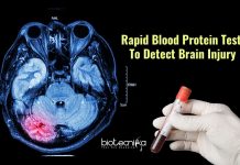 blood test for brain injury