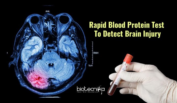 blood test for brain injury