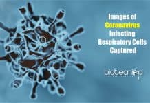 Scientists Capture Images of SARS-CoV-2 Infecting Respiratory Cells Images of Coronavirus Infecting Cells