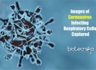 Images of Coronavirus Infecting Cells