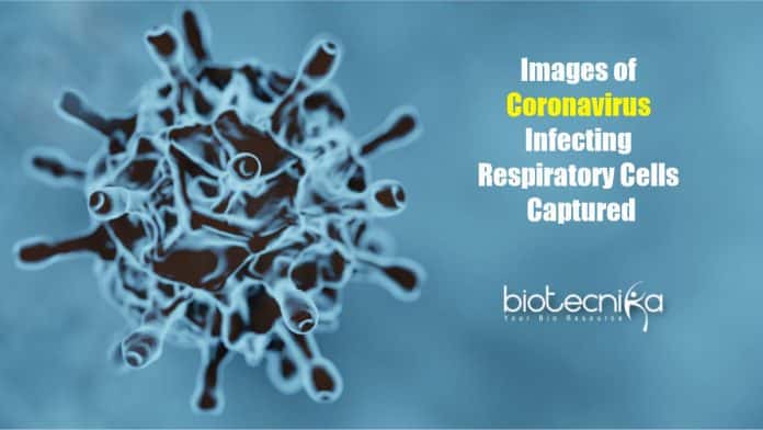 Images of Coronavirus Infecting Cells