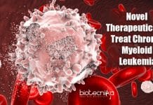 Scientists Develop Novel Therapeutics To Treat Chronic Myeloid Leukemia In Mice chronic myeloid leukemia