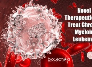 chronic myeloid leukemia