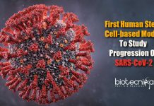 First Human Stem Cell-Based Model To Study Progression Of SARS-CoV-2 & Other Viruses First human stem cell-based model