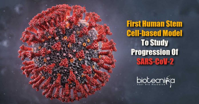 First human stem cell-based model