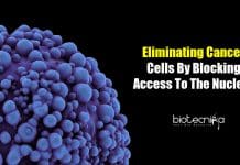 Nuclear Pore Complex and Cancer