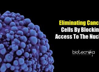 Nuclear Pore Complex and Cancer