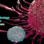 IISc develops bandage to treat skin cancers