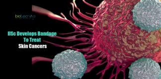 IISc develops bandage to treat skin cancers