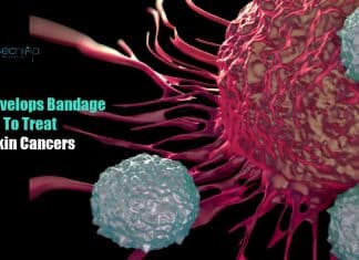 IISc Researchers Develops Bandage That Can Treat Skin Cancers IISc develops bandage to treat skin cancers