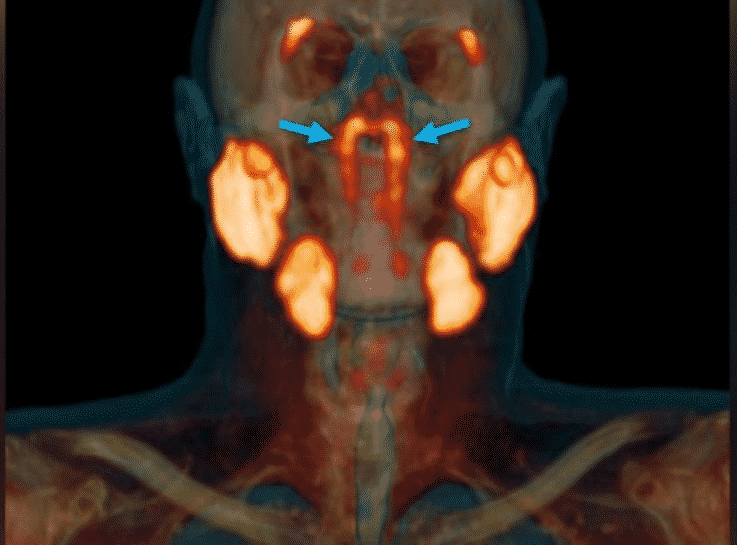 New Organ Discovered in human body