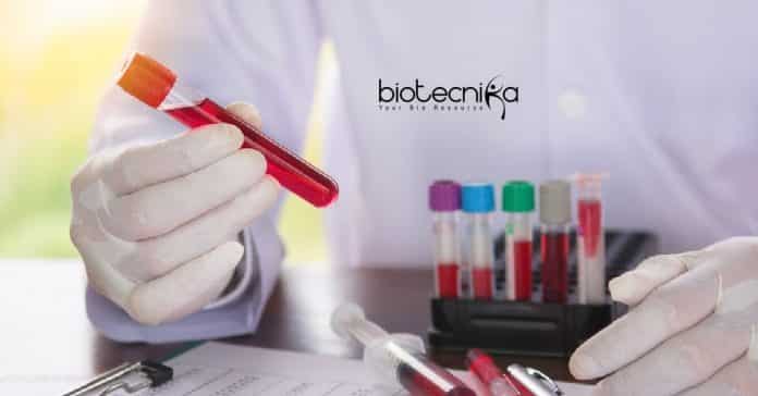 Syngene Immunology Research