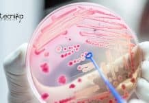 ICAR-IISS Microbiology Senior Research Fellow Job Opening ICAR-IISS Microbiology