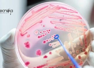 ICAR-IISS Microbiology Senior Research Fellow Job Opening ICAR-IISS Microbiology