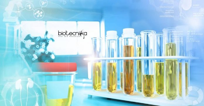 IIT Delhi Biotech &