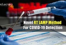 RT-LAMP Technology: A Novel COVID-19 Detection Method RT LAMP Based COVID Test
