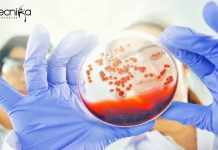 Amity Institute of Microbial Technology Life Sciences JRF Job Amity Institute of Microbial