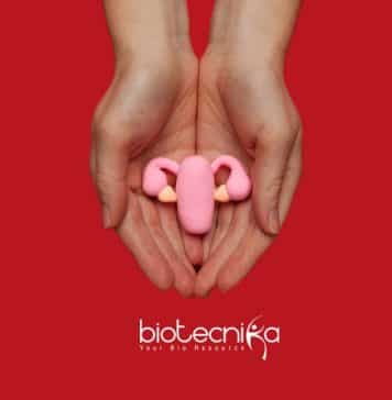 ICMR-NIRRH DBT Wellcome India Alliance Project Assistant Recruitment ICMR-NIRRH Project Jobs