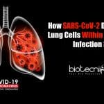 How SARS-CoV-2 Damages Lung Cells
