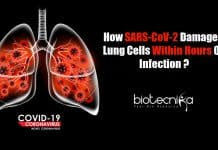 Boston Scientists Decode How Coronavirus Damages Lung Cells Within Hours How SARS-CoV-2 Damages Lung Cells