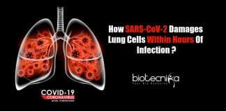 How SARS-CoV-2 Damages Lung Cells