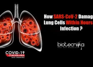 Boston Scientists Decode How Coronavirus Damages Lung Cells Within Hours How SARS-CoV-2 Damages Lung Cells