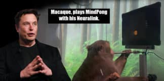Neuralink Monkey Brain Implant