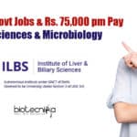 ILBS Delhi Job
