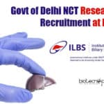 Govt of Delhi NCT Research Fellow Recruitment at ILBS ILBS Delhi JRF Opening