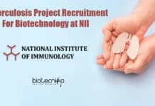 Tuberculosis Project Recruitment For Biotechnology at NII NII Jobs Biotechnology