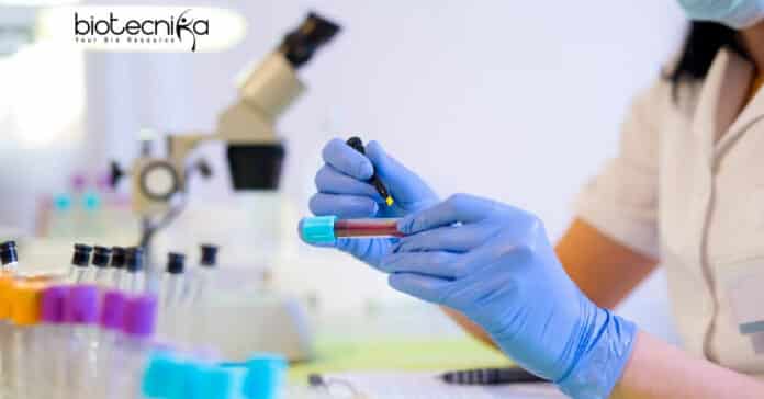 ACTREC Vacancy JRF